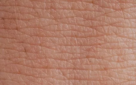 Skin closeup