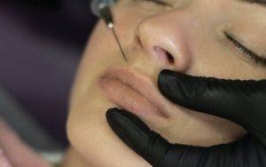 Cosmetic procedure Injection face