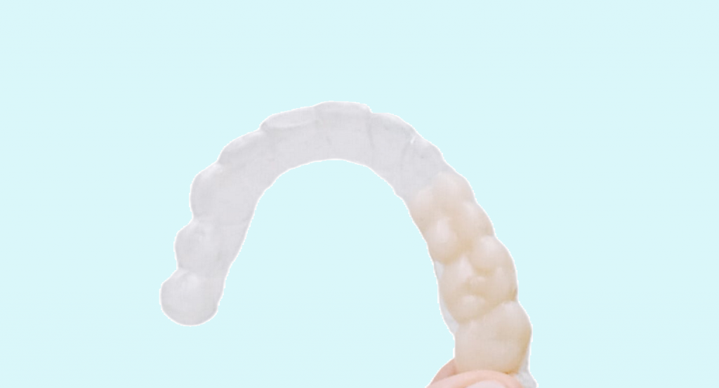 Clear braces vs clear aligner