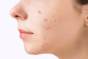 Most Common Skin Conditions