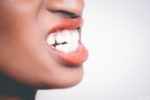 Cosmetic Dentistry: Teeth Whitening, Bleaching